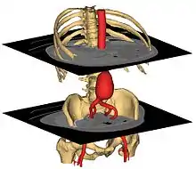 Description de l'image 3D surface models from abdominal CT .jpg.