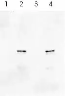 photographie montrant deux bandes noires en vis à vis sur fond gris clair