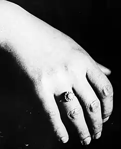 La bague de Marguerite Steinheil, photographiée à sa main lors de son procès.