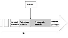 Description de l'image Amnesie.jpg.