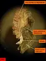 Arenicola marina. Néphrostome vu par la face ventrale et gonade.