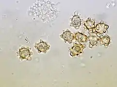Chlamydospores, organes de reproduction végétative.