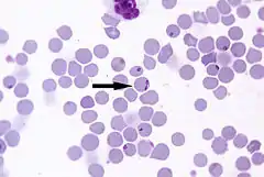 Description de l'image Babesia-divergens.jpg.