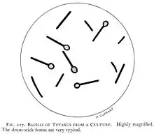 représentation très schématisée de bacilles tétaniques sous forme de bâtonnets renflés à une de leur extrémité