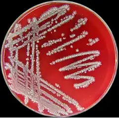 Description de l'image Bacillus licheniformis.jpg.