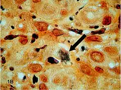 Description de l'image Bacteria on Warthin–Starry stain.jpg.