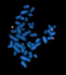 caryotype avec hydridation in situ