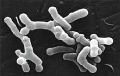 Description de l'image Bifidobacterium longum en microscopie électronique.jpg.