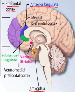 Description de l'image Borderline Personality Disorder (BPD) Abnormal Brain Structures.png.