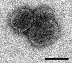 Description de l'image Bourbon virus sphere (EID 2015 Fig 2b).jpg.