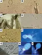Buwchfawromyces eastonii (Neocallimastigomycota)