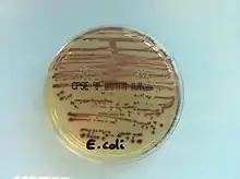 Culture d'Escherichia coli sur CPS E à partir d'une urine.
