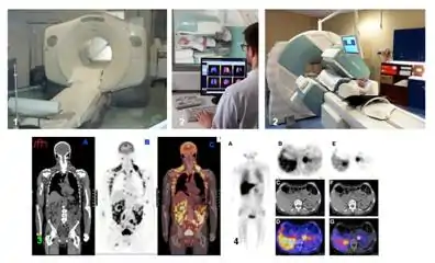 Caméras et images de médecine nucléaire