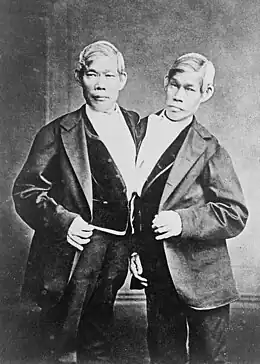 Chang et Eng Bunker (11/05/1811-17/01/1874), siamois thaïlandais.