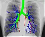 Anatomie radiographique d'une poitrine humaine.