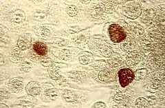 Description de l'image ChlamydiaTrachomatisEinschlusskörperchen.jpg.
