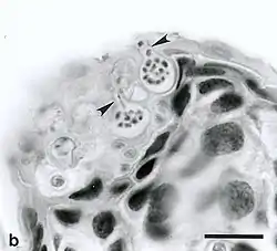 Photo en noir et blanc d'une vue au microscope optique d'une coupe de peau d'un amphibien infecté par le chytridiomycète, montrant deux sporanges contenant des zoospores.