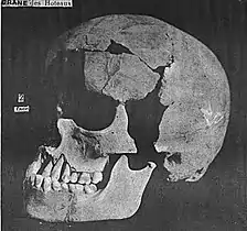 Grotte des Hoteaux, crâne magdalénien découvert par Joseph Tournier et Charles Guillon