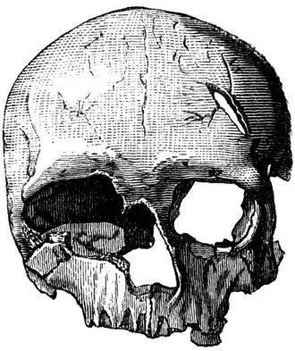 Crâne d’un Homme de Cro-Magnon (féminin).