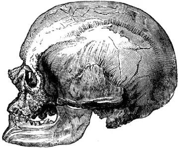 Crâne d’un Homme de Cro-Magnon (masculin).