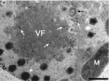 Image montrant des CroV infectés par des mavirus.