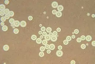 Description de l'image Cryptococcus neoformans using a light India ink staining preparation PHIL 3771 lores.jpg.