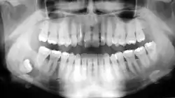 Image illustrative de l’article L'Homme aux dents d'or