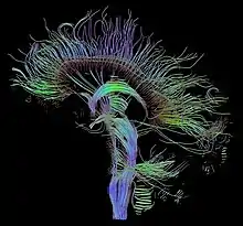 Image de tractographie. Des fibres sont visibles dans une vue tridimensionnelle du cerveau.