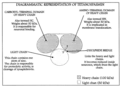 Structure de la tétanospasmine