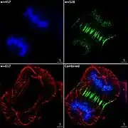 Imagerie en épifluorescence de trois composantes d'un cellule cancéreuse humaine en cours de division. L'ADN apparaît bleu, une protéine dite INCENP apparaît en vert, et les microtubules en rouge. Chaque fluorophore a été imagé séparément, avec une longueur d'onde d'excitation spécifique et des filtres, puis une image a été recomposée, à partir des photos prises par la caméra CCD.