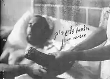 Photo d'archive en noir et blanc d'un homme dans un lit d'hôpital, levant un bras à la main amputée.