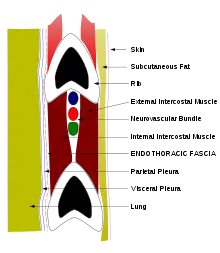 Schéma d'une coupe verticale d'un espace intercostal montrant de haut en bas, la côte supérieure, le paquet vasculo-nerveux avec dans l'ordre la veine, l'artère et le nerf, puis à distance la côte inférieure, de part et d'autre du paquet un muscle intercostal, l'un à l'extérieur, l'autre à l'intérieur