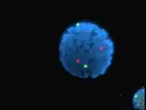 Noyau de lymphocyte humain coloré au DAPI avec les chromosome 13 (vert) et 21 (rouge) par des sondes hybridées aux centromères (hybridation in situ en fluorescence).
