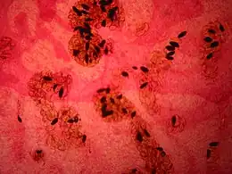Description de l'image Fasciola hepatica 01 Pengo.jpg.