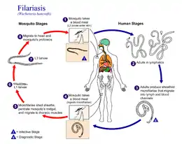 Description de l'image Filariasis 01.png.