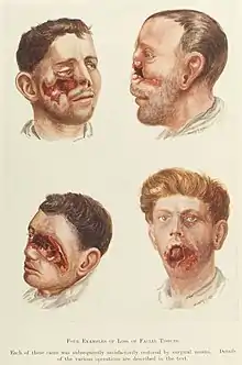 dessin en couleurs de visages mutilés.