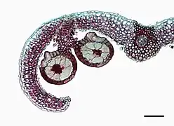 Coupe d'un sore de Gleichenia sp. contenant des sporanges (sphères), contenant des spores (points noirs).