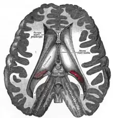 Dissection montrant les ventricules du cerveau.