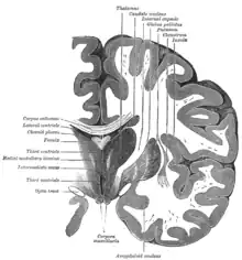 Section coronale du cerveau à travers la masse intermédiaire du 3e ventricule.