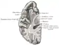 Section du cerveau faisant apparaître la surface supérieure du lobe temporal.