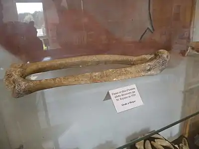 Fémur et tibia d'homme.