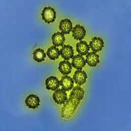 Description de l'image H1N1 Influenza Virus Particles (8411599236).jpg.