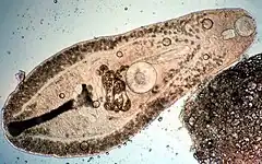 Helicometra sp. (Trematoda)