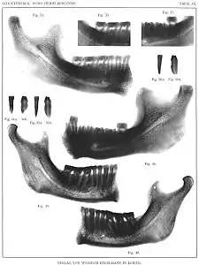 Radiographie.