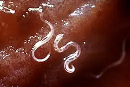 Description de l'image Hookworms.JPG.