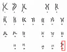 Photographie microscopique des 23 paires de chromosomes humains, parmi lesquelles on distingue la paire des chromosomes sexuels où l'on range le chromosome Y.