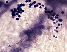 Conidiophore de Hyaloperonospora parasitica portant de nombreuses conidies