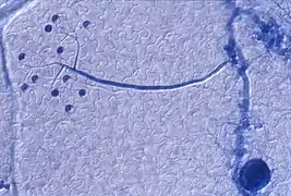 Dernière étape du cycle court de H. parasitica : apparition d'un conidiophore (structure arbusculaire bleue portant les conidiospores