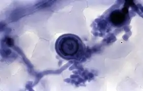 Étape reproductive du cycle court de H. parasitica : hyphes de Hyaloperonospora parasitica dans une feuille d’Arabidopsis thaliana (microscope optique). Les sphères plus grosses et très sombres sont les Oospores (forme de stockage à long terme de H. parasitica).