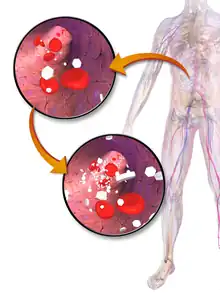 Les hexagones blancs dans l'image représentent des molécules de glucose, qui sont augmentées dans l'image inférieure.